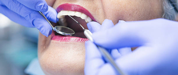 Best Urgent Care for Lost Fillings or Crowns in Havana, IL